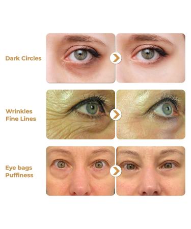 ABERA Natural Repair Eye Cream | Reduce Dark Circles Wrinkles & Puffiness | 0.5 fl oz - Buy Online on GoSupps.com