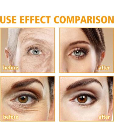 Crsetmyth Lifting eye cream effective antiaging eye care firming eye cream moisturizing eye cream for dark circles and puffiness against wrinkles for undereye circles bags and swelling - Buy Online on GoSupps.com