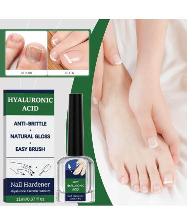 Soin des ongles l'acide hyaluronique avec vitamine E et huile de jojoba soin des ongles et vernis ongles acide hyaluronique soin des ongles avec acide hyaluronique pour mains et pieds (1 pi ce) 1 pi ce. - Buy Online on GoSupps.com