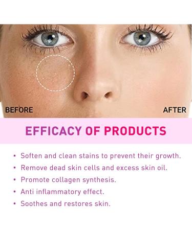 Milia Removal Face Serums Milia Spot Remover Milia Remover Milia Spot Serum for Face Milia Serum for Face Milia Spot Serum Helps to Ruduce Milia Reduces Bags Saggy Skin & Puffy Eyes 30ML - Buy Online on GoSupps.com