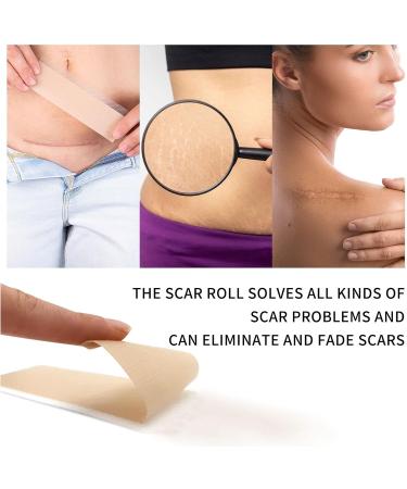 ZORCK Scar Sticker Silicone Tape Roll - 1.5in x 118in - Effective Scar Removal for Caesarean Section, Keloid, Burns & Acne - Buy Online on GoSupps.com