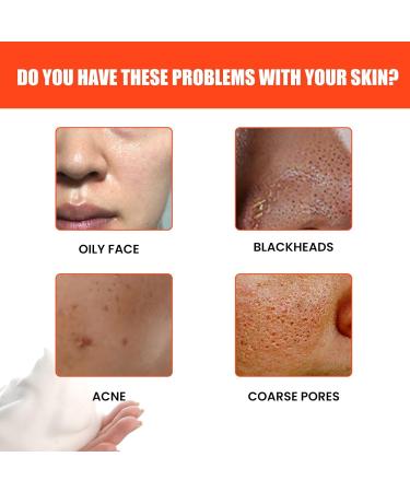 Men's Facial Cleanser - Deep Pore Cleansing Anti-Acne & Blackhead Remover Oil Control & Moisturizing Formula(1PCS) - Buy Online on GoSupps.com