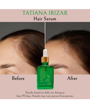 Hair Growth Serum for Men & Women - Vegan Rosemary & Amla Treatment for Thickening & Strengthening | 1 Fl Oz (Pack of 2 - Buy Online on GoSupps.com