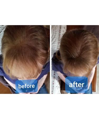 Caboki VALUE PACK 2 (3 x 30 gram plus one Volume Control Mist) 270-Day Supply Light Brown - Buy Online on GoSupps.com