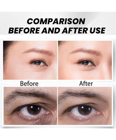 Anti Wrinkle Eye Cream Anti Aging Under Eye Cream for Dark Circles Puffy Eyes Instant Tightening Hydrating and Firming Eye Serum Creams Eye Repair Cream Anti-Aging Eye Care for All Skin Types - Buy Online on GoSupps.com