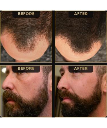 Hairline Powder by The Beard Struggle - Root Touch Up Hair Color for Men | Conceals Hair Loss & Bald Spots | Sweat Resistant Dark Brown - Buy Online on GoSupps.com