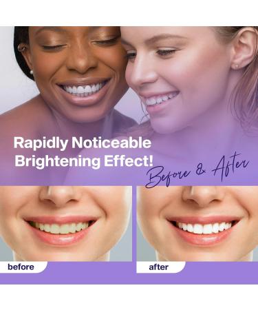 Purple Teeth Whitening Toothpaste - 30ml for Effective Whitening | International Shipping Available - Buy Online on GoSupps.com