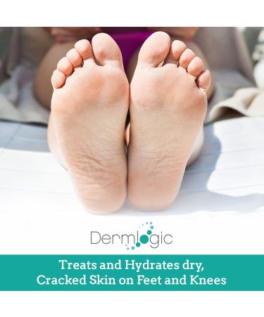 Keratosis Pilaris Treatment - 12% Lactic Acid Lotion for Bumps Body Acne & Rough Skin Relief | Moisturizing Repair Cream - Buy Online on GoSupps.com