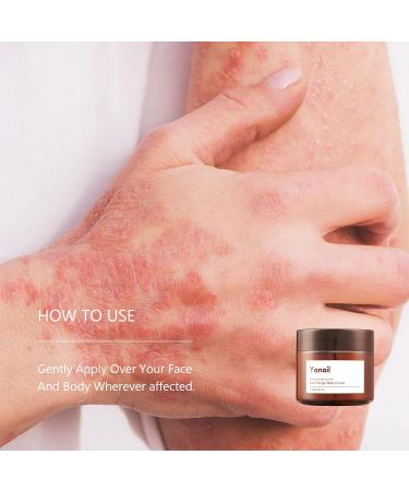 Anti Fungal Nail Treatment Cream Yanail Toe Nail Fungal Treatment Foot Fungus Treatment Anti fungal Cream Foot Fungus Cream Foot Cream 60g - Buy Online on GoSupps.com