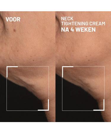 Dr Brandt Skincare Dr Brandt Needles No More Neck Tightening Cream Lifts firms and reduces sagging skin Includes a rose quartz Gua Sha tool 50 g - Buy Online on GoSupps.com