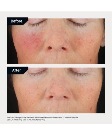 Revision Skincare C+ Correcting Complex 30% Vitamin C Serum for Face Anti-Aging Treatment to Brighten Skin Reduce Fine Lines Wrinkles & Dark Spots Firming & Safe for Sensitive Skin 0.5 oz - Buy Online on GoSupps.com