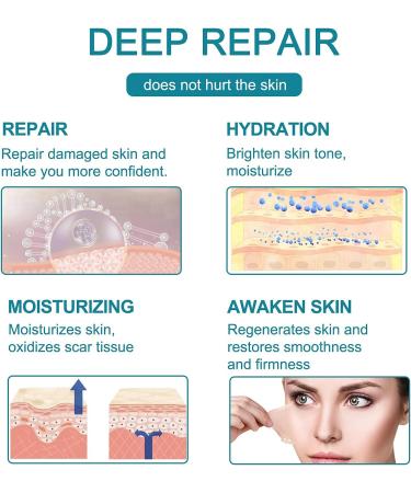 Medical Grade Silicone Gel Scar Removal Tape 1.6x60 - Long Strips for Acne, C-Section, Keloid Surgery - 6-8 Month Supply - 1.5m - Buy Online on GoSupps.com