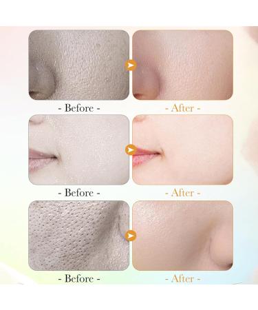 Vitamin C Face Cleanser Gentle Face Cleanser For Sensitive Skin & Oily Skin Sensitive Face Wash Women & Men For Dry Skin Facial Cleanser For Blackheads Acne Dull Skin Hydrated - Buy Online on GoSupps.com