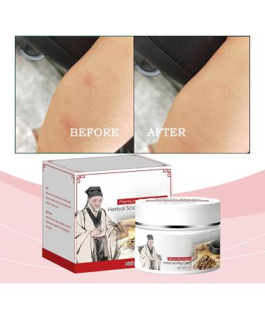  CongRong Set of 3 natural herbal soothing creams to naturally relieve problems for all skin types non-stinging soft texture safer to use for dry skin and - Buy Online on GoSupps.com