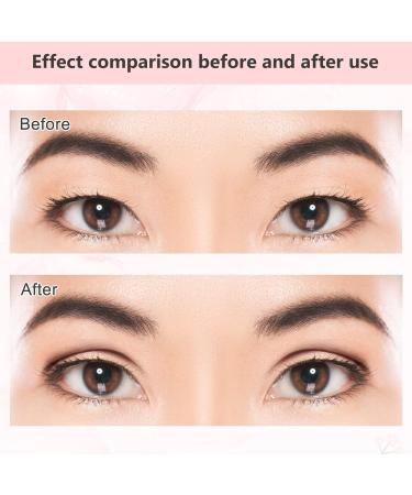 240 PCS Eyelid Tapes Invisible Eyelid Strips Kit Instant Eyelid Stickers Natural Single Side Eyelid Tape Instant Eyelid Lift Tape Eyelid Lift Strips Double Sided With Spray Bottle for Droopy Lids - Buy Online on GoSupps.com