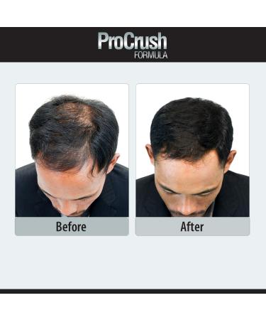 Biotin Hair Growth Support Multivitamin for Longer, Fuller, Thicker Hair - Natural Supplement for Healthy Skin - Buy Online on GoSupps.com