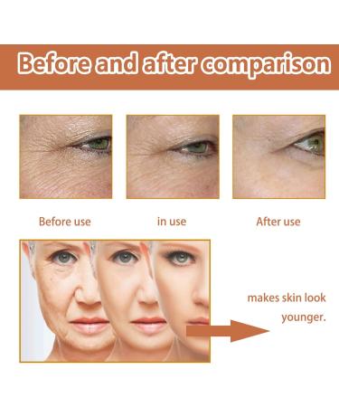 Hyaluronic Acid Serum for Face - Face Serum for Women - Cheery Dark Spot Remover for Face Serum - Anti-Aging Skin Firming - Moisturizing and Whitening - Mild Formula 30ml - Buy Online on GoSupps.com