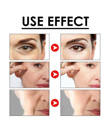 Chaffelife Snake Venom Peptide Eye Cream - Anti-Wrinkle Firming & Dark Circle Treatment (4 Pieces) - Best Skin Tightening Solution - Buy Online on GoSupps.com