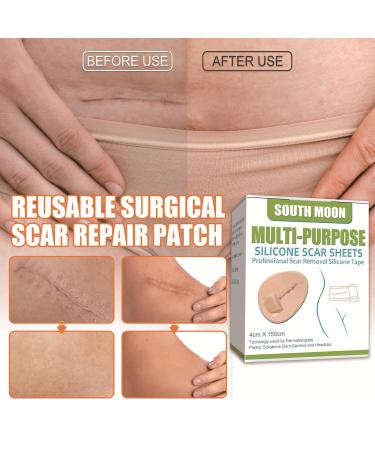 Medical Grade Silicone Scar Sheets - C-Section Surgery Burn Keloid & Acne Treatment | 1.6 x 60 Roll - Buy Online on GoSupps.com