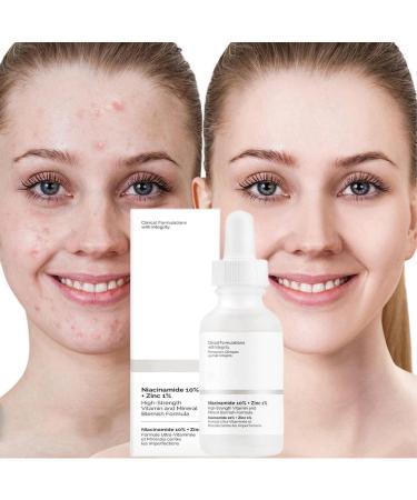 10% Niacinamide Serum+ 1% Zinc Serum Niacinamide Face Serum Niacinamide and Zinc Face Moisturiser Anti Aging & Wrinkle Face Serum Tackles Blemishes Minimises Pore Face Serum for Women Skincare Serum - Buy Online on GoSupps.com