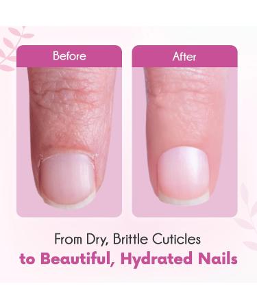 Banana Fragrance Cuticle Oil 12ml - Moisturizing Nail Treatment for Dry Skin - Buy Online on GoSupps.com