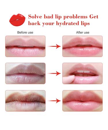 Gel Collagen Lip Mask Pads | Moisturizing Anti-Aging & Hydrating | Crystal Lip Treatment - Buy Online on GoSupps.com