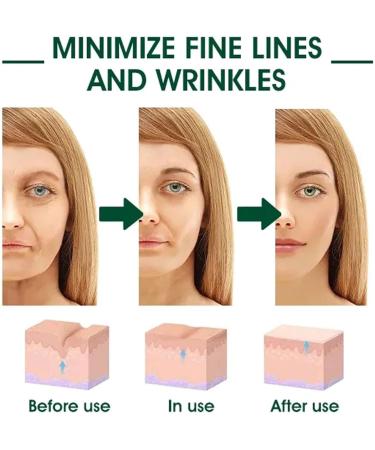 Skin Firming Rejuvenating Moisturising Essence with Hyaluronic Acid Firming Cream for Face and Neck Moisturising Firming Face Firming - Buy Online on GoSupps.com
