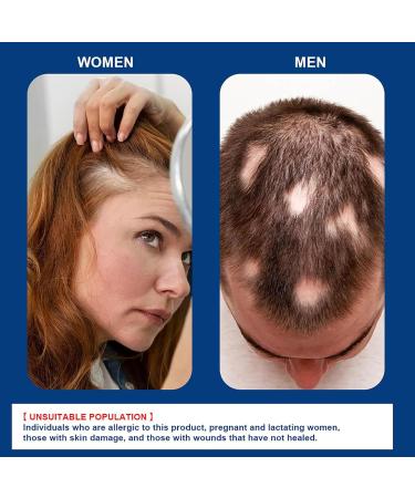  Generisch Areata Anti-Alopecia Cream - Repairing Cream for Hair Regrowth with Sophora Flavescens | Scalp Treatment for Baldness and High Hairline | Natural Formula - Buy Online on GoSupps.com