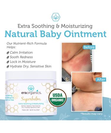 Era Organics Healing Ointment for Babies USDA Certified Organic Natural Gentle Moisturizer for Sensitive Skin Prone To Baby Eczema Cradle Cap - 4 Oz - Buy Online on GoSupps.com
