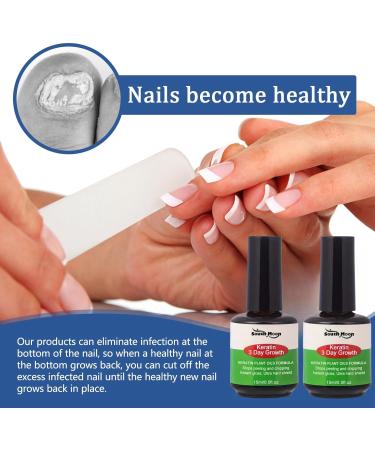 Keratin Nail Growth Oil Nail Strengthener for Damaged Nails - Buy Online on GoSupps.com