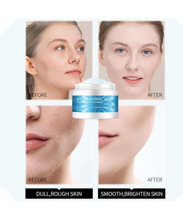 Hyaluronic Acid Face Cream Hyaluronic Acid Moisturiser Face Women & Men Anti Aging & Anti Wrinkle Face Cream Face Moisturiser For Mature & Young Skin Hydrate Smooth Dry Skin - Buy Online on GoSupps.com