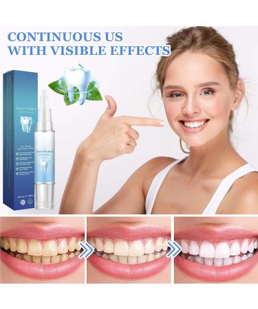 BSOON Gums Therapy Gel - 3 Tooth Whitening Pins & Gum Shield | Teeth Whitening Essence for Stain Removal - Buy Online on GoSupps.com