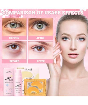 HANGGON Eye pillow 12 pairs 15g retinol eye cream eye pillow with hyaluronic acid eye pillow eye cream can fight against dark circles wrinkles swelling eye bags antiaging eye mask eye care eye - Buy Online on GoSupps.com