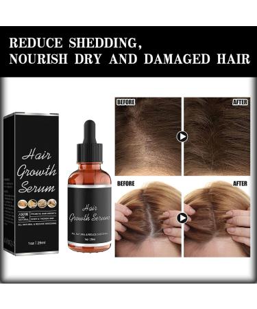 Women Hair Growth Serum | Fast Veganic Natural Hair Growth Oil for Black Women | Anti-Hair Loss Solution - Buy Online on GoSupps.com
