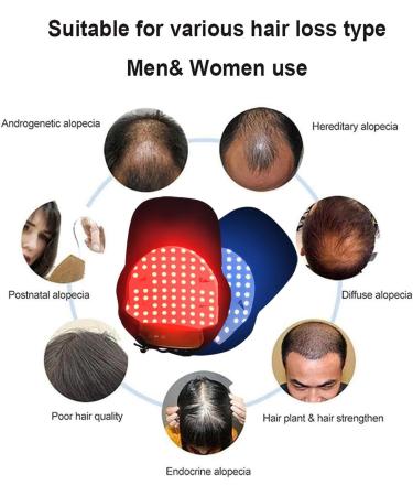oiakus Red Light Therapy Cap Portable Hair Growth Cap Red Light Therapy for Hair Loss 70 LEDs 2 Adjustable Vibration Levels - Buy Online on GoSupps.com