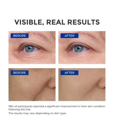 SKINERSE Retinol Serum for Face Anti Aging Serum Retinoid Collagen with Vitamin E Resurfacing Facial Rapid Fine Lines Repair Brightening Pore Minimizer for Face Daily Skin Care Treatment 1oz - Buy Online on GoSupps.com