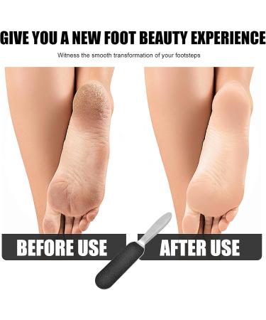 Double-Sided Pedicure Foot File & Callus Remover for Hard Skin Professional Stainless Steel Foot Rasp File with 10 Replacement Refill Grits Papers Foot Files for Hard Skin for Home Pedicure - Buy Online on GoSupps.com
