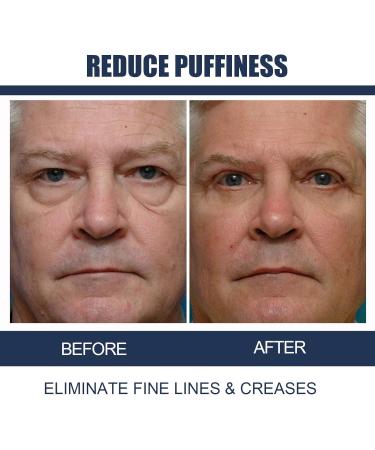 Peptide Lifting Eye Gel Peptide Lifting Eye Gel nordizoe openeyes Lifts Firming Anti-wrinkle Eye Tightener Men Eye Cream Anti Aging (2Pcs) - Buy Online on GoSupps.com