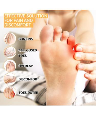 Bunion Corrector Kit - 7 Pack Set for Hallux Valgus Relief - Non-Surgical Toe Separator and Protector - Pain Relief Sleeves for Women and Men - Buy Online on GoSupps.com