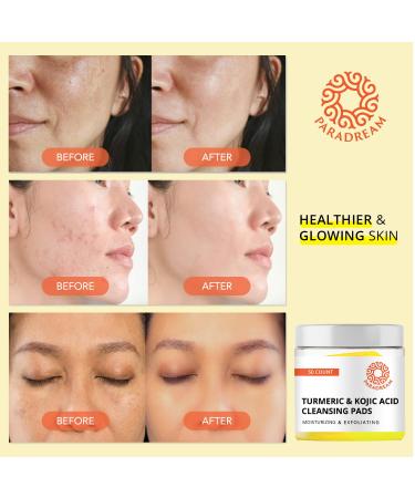 Paradream Turmeric Kojic Acid Cleansing Pads: Face Exfoliating Scrub Pads for Dark Spots - Deep Clean Pores Suitable for all Skin Types 50PCS 50 Count (Pack of 1) - Buy Online on GoSupps.com