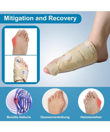 Hallux Valgus Correction Rail - Relief for Toe Pain & Alignment | Beige Left Bandage for Men & Women - Buy Online on GoSupps.com