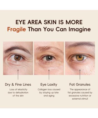Vitamin C Roller Eye Serum Anti-Aging Eye Serum Minimizes Wrinkles Dark Circles Reduces Puffiness Sagging Skin Around Eyes Moisturizing Hydrating Daily Eye Serum - Buy Online on GoSupps.com