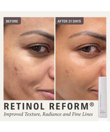 Shani Darden Skincare Retinol Reform Anti-Aging Serum 1.01 fl oz - Reduce Fine Lines, Wrinkles, Hyperpigmentation & Texture | Minimal Irritation | Pack of 1 - Buy Online on GoSupps.com