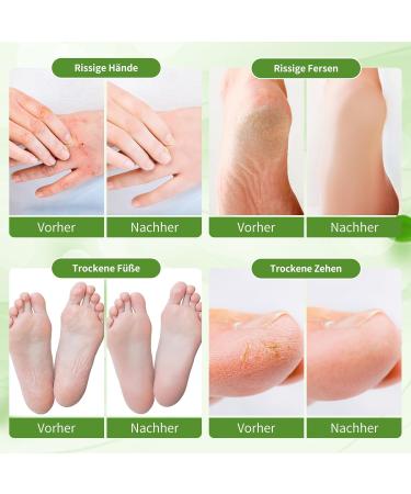  nbc BeautiLab Callus Remover Cream - Hand & Foot Cream for 24 Hours Hydration & Care 80ml - Foot Cream with Glycerin Mineral Oil Vitamin E for Skin Plus - Buy Online on GoSupps.com