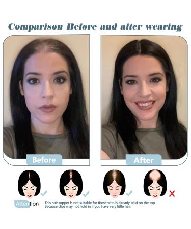 SARO-UP 10 Real Human Hair Clip-In Hair Topper for Women with Thinning Hair - Medium Brown & Honey Blonde (P4/27) - Hair Extensions for Thinning Hair/Hair Loss - Buy Online on GoSupps.com