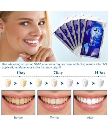 28 Tooth Whitening Strips - Remove Tough Stains & Brighten Teeth Gently | Enamel Safe Whitening - Buy Online on GoSupps.com