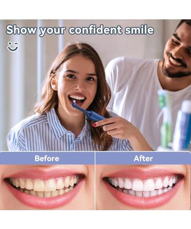 BlueFire Teeth Cleaning Kit for Daily Cleaning Waterproof Teeth Cleaning Tools with 6 Brush Heads 4 Speed Modes and LED Lights Teeth Cleaning Brush for People/Pets(Blue) - Buy Online on GoSupps.com
