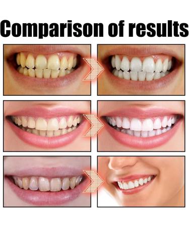 Cocofresha Extraction Oil Cocofresha Coconut Extraction Oil Cocofresha Extraction Oil for Teeth and Gums Walnut Peppermint Extraction Oil (3Pcs) - Buy Online on GoSupps.com