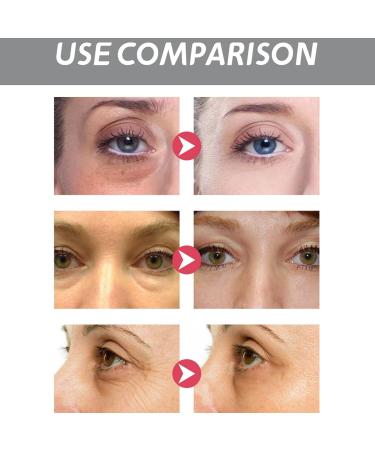 Instant Eye Tightener Eye Bag Cream for Tightens and Smoothes Firming Eye Cream Instant Eye Bag Removal Temporary Eye Cream for Dark Circles and Puffy Eyes Fade Fine Lines Firm Eye Cream Anti Aging - Buy Online on GoSupps.com