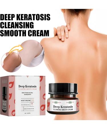 Keratosis Pilaris Cream Strawberry Legs Treatment Cream for Women Exfoliating Body Cream Skin Exfoliating Repair Cream Chicken Skin Treatment Moisturizing Cream Gets Rid Of Redness - Buy Online on GoSupps.com